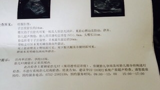 汽车行车记录仪主控芯片NT96658好坏检测实操指南（汽车维修场景适配，新手也能快速排查）